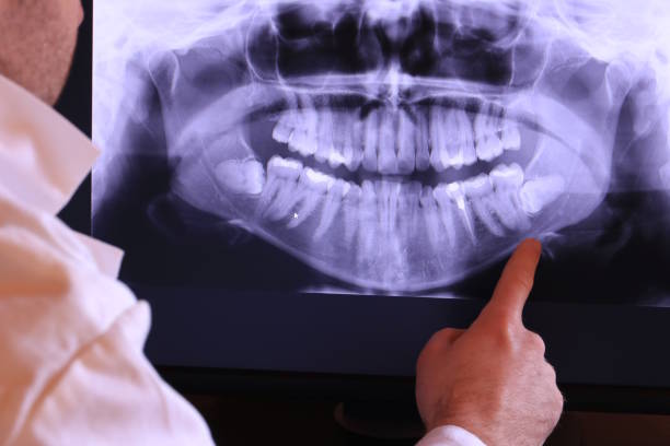 Best Emergency Treatment for Oral Infections in Richlands, VA