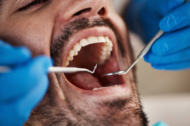 Best Walk-In Emergency Dental Services in Richlands, VA